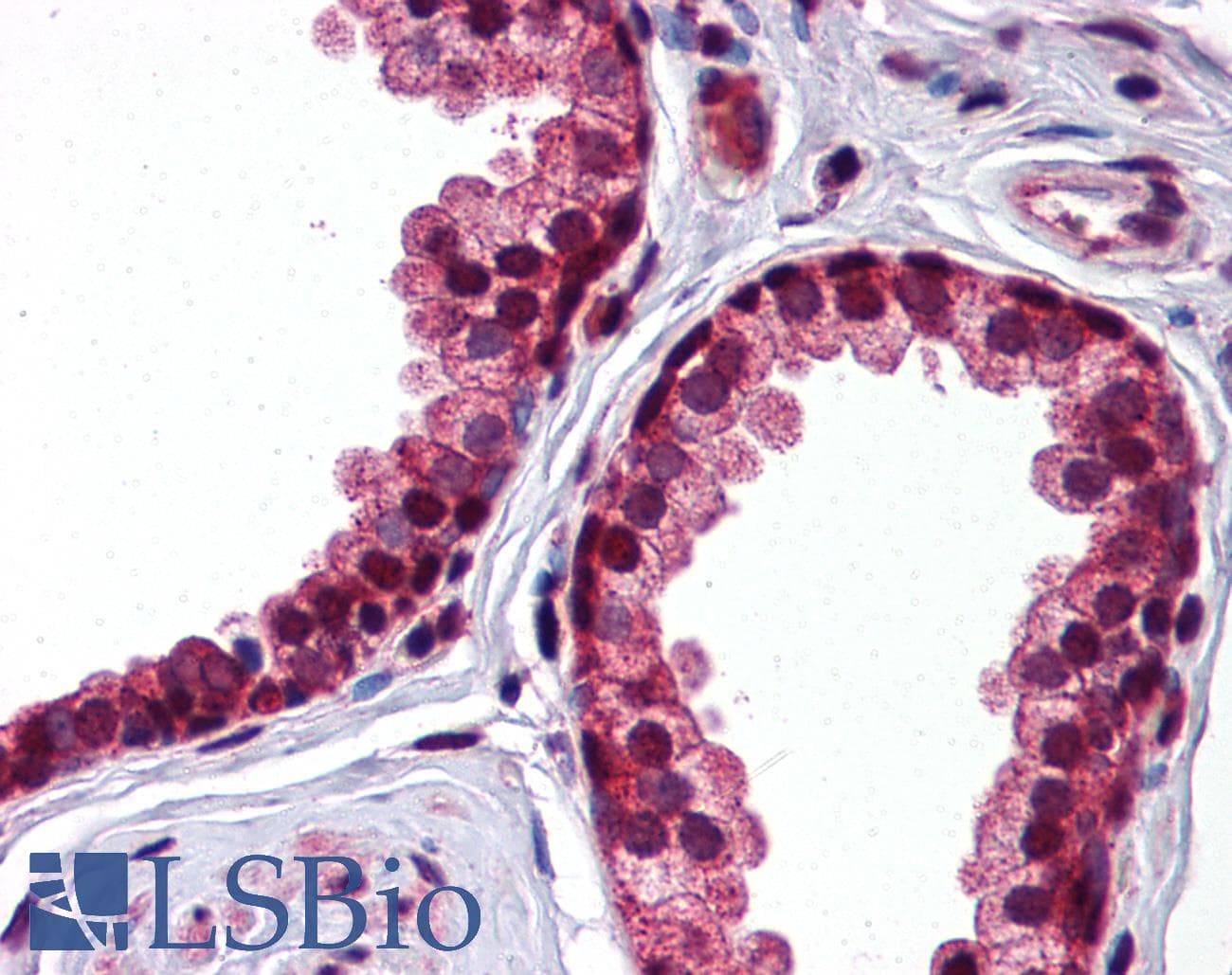 PathPlus™ Alpha-1-Antichymotrypsin Antibody (aa254-303)