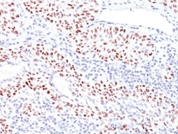 TP53 / p53 Antibody (clone TRP/816, Azide-free, BSA-free)