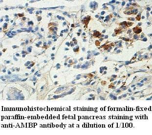 Polyclonal Rabbit anti-Human AMBP Antibody (aa2-250, IHC, WB)