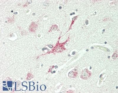 IHC-plus™ Polyclonal Rabbit anti-Human GBA / Glucosidase Beta Acid Antibody (IHC, WB)