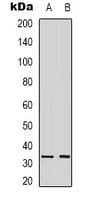 NCR1 / NKP46 Antibody (Internal)