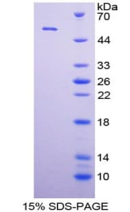 Human MAPK7 / ERK5 Protein (Recombinant His-GST)