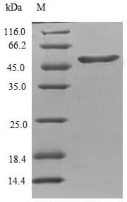 Human TPPP Protein (Recombinant GST, N-terminus)