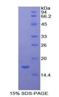 Rat LYZ / Lysozyme Protein (Recombinant His)