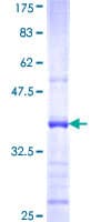Human IL22RA1 / IL22R Protein (Recombinant GST, N-terminus)