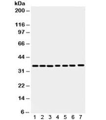 ANXA3 / Annexin A3 Antibody