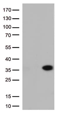MIBP / ITGB1BP3 Antibody (clone OTI3H9)