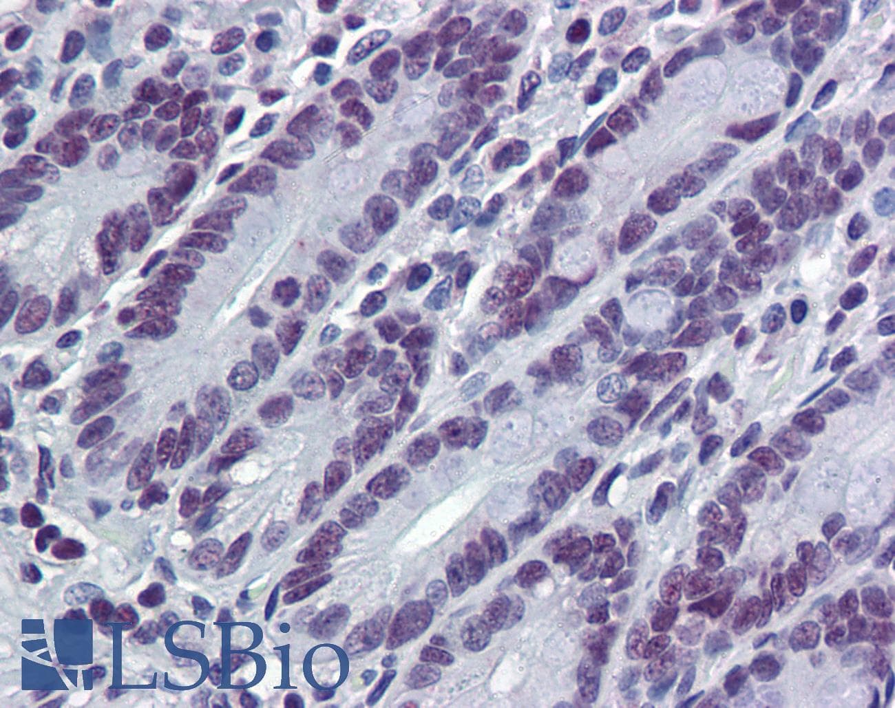 IHC-plus™ HDAC1 Antibody (clone 1D6)