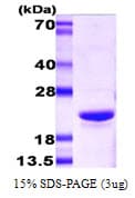 Mouse CRYAB / Alpha B Crystallin Protein (Recombinant)