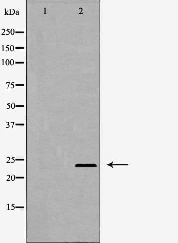 PSMD10 / Gankyrin Antibody