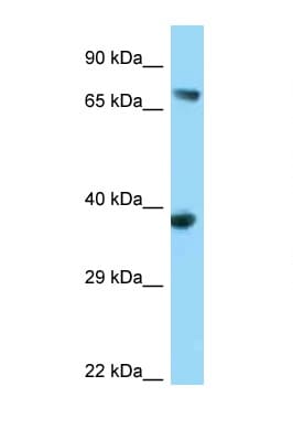 Polyclonal Rabbit anti-Human ADAP / FYB Antibody (aa39-88, WB)