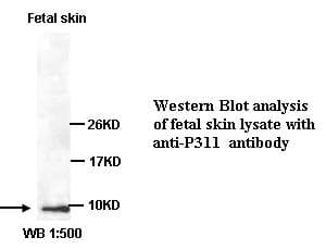 C5orf13 Antibody (C-Terminus)