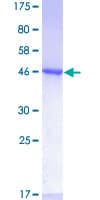 Human RHOA Protein (Recombinant GST)