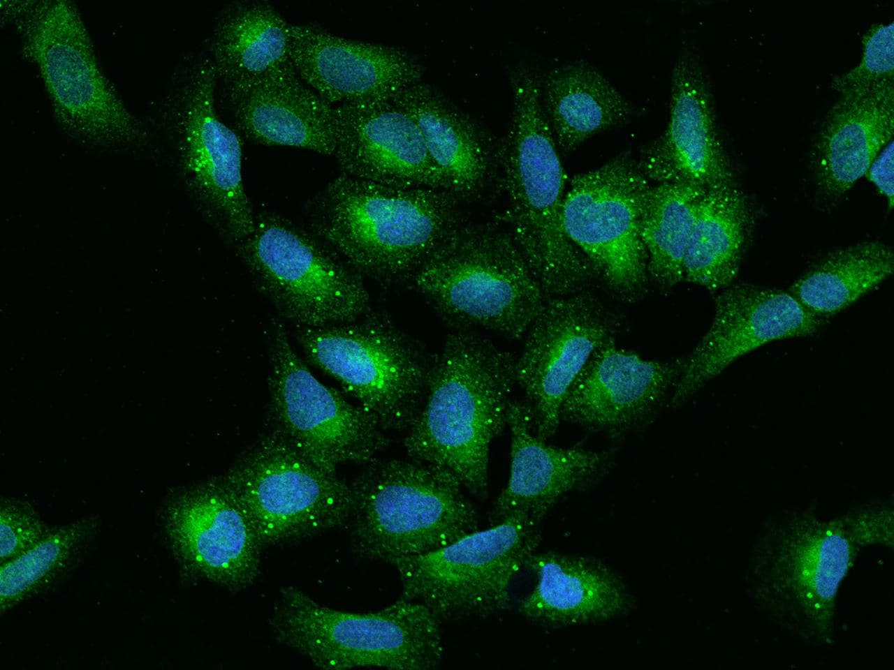Polyclonal Rabbit anti-Human VAP33 / VAPA Antibody (IHC, IF)