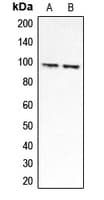 Polyclonal Rabbit anti-Human CLCN6 Antibody (Internal, WB)