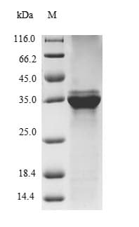 Mouse SAA1 / SAA / Serum Amyloid A Protein (Recombinant 6His-SUMO, N-terminus)