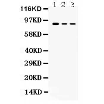 Polyclonal Rabbit anti-Human ATXN1 / SCA1 Antibody (aa778-808, IHC, WB)