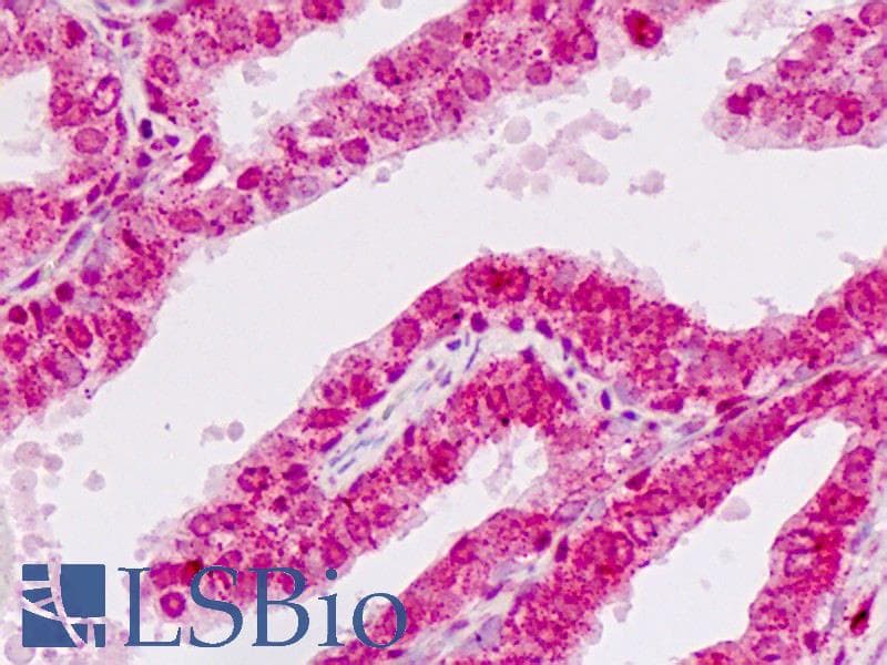 IHC-plus™ E2F1 Antibody (Ser332)