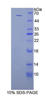 PCNA Protein (Recombinant His-GST-S)