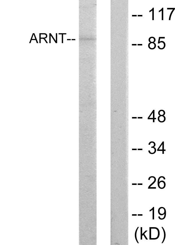 ARNT / HIF-1-Beta Antibody (aa31-80)