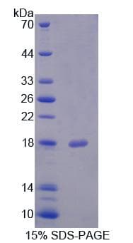 Human FIS1 Protein (Recombinant His-T7)