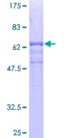 Human TCN2 Protein (Recombinant GST)