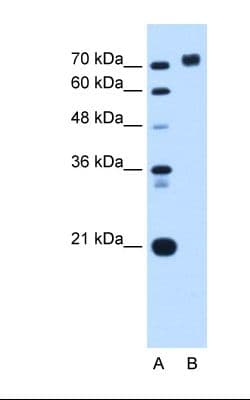PTPRN / IA-2 Antibody (aa32-81)