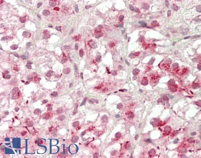 IHC-plus™ Polyclonal Rabbit anti-Human CUX1 / CASP Antibody (IHC, WB)