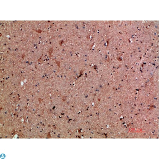 Polyclonal Rabbit anti-Human CLCF1 Antibody (IHC)