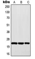 MAD2L1 / MAD2 Antibody (Internal)
