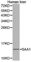 Polyclonal Rabbit anti-Human SAA1 / SAA / Serum Amyloid A Antibody (IHC, WB)