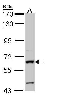 ALPI / Alkaline Phosphatase Antibody (aa3-206)