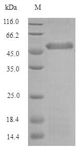 Cow PTX3 / Pentraxin 3 Protein (Recombinant DDK,C-terminus)