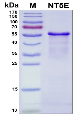 Human NT5E / eNT / CD73 Protein (Recombinant His, N-Terminal)