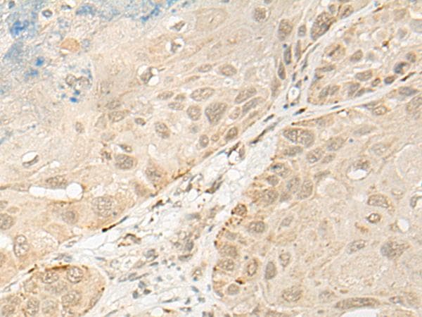 Polyclonal Rabbit anti-Human OTX1 Antibody (IHC)