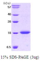 Human KITLG / SCF Protein (Recombinant)