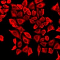 RARA / RAR Alpha Antibody