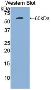 PLAT / TPA Antibody (aa311-562)