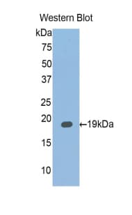 IL6R / IL6 Receptor Antibody (aa52-204, Biotin)