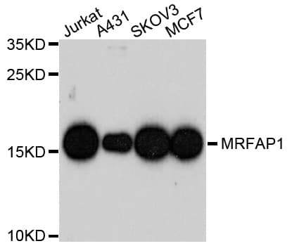 Polyclonal Rabbit anti-Human MRFAP1 / PGR1 Antibody (AP, IHC, WB)