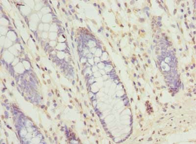 Polyclonal Rabbit anti-Human SEC61G Antibody (IHC)