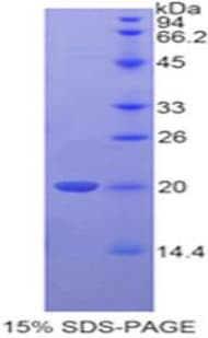 Human TAZ Protein (Recombinant His-T7)