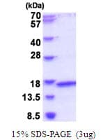 Human MRPL2 Protein (Recombinant His)