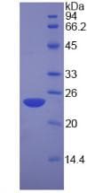 Human NCL / Nucleolin Protein (Recombinant His, N-Terminal)