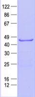 Human KRT18 / CK18 / Cytokeratin 18 Protein (Recombinant His, N-Terminal)