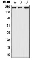 Polyclonal Rabbit anti-Human SCN8A / Nav1.6 Antibody (Internal, WB)