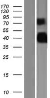 PRR5 Protein (Over-Expression Lysate Myc-DDK (Flag))