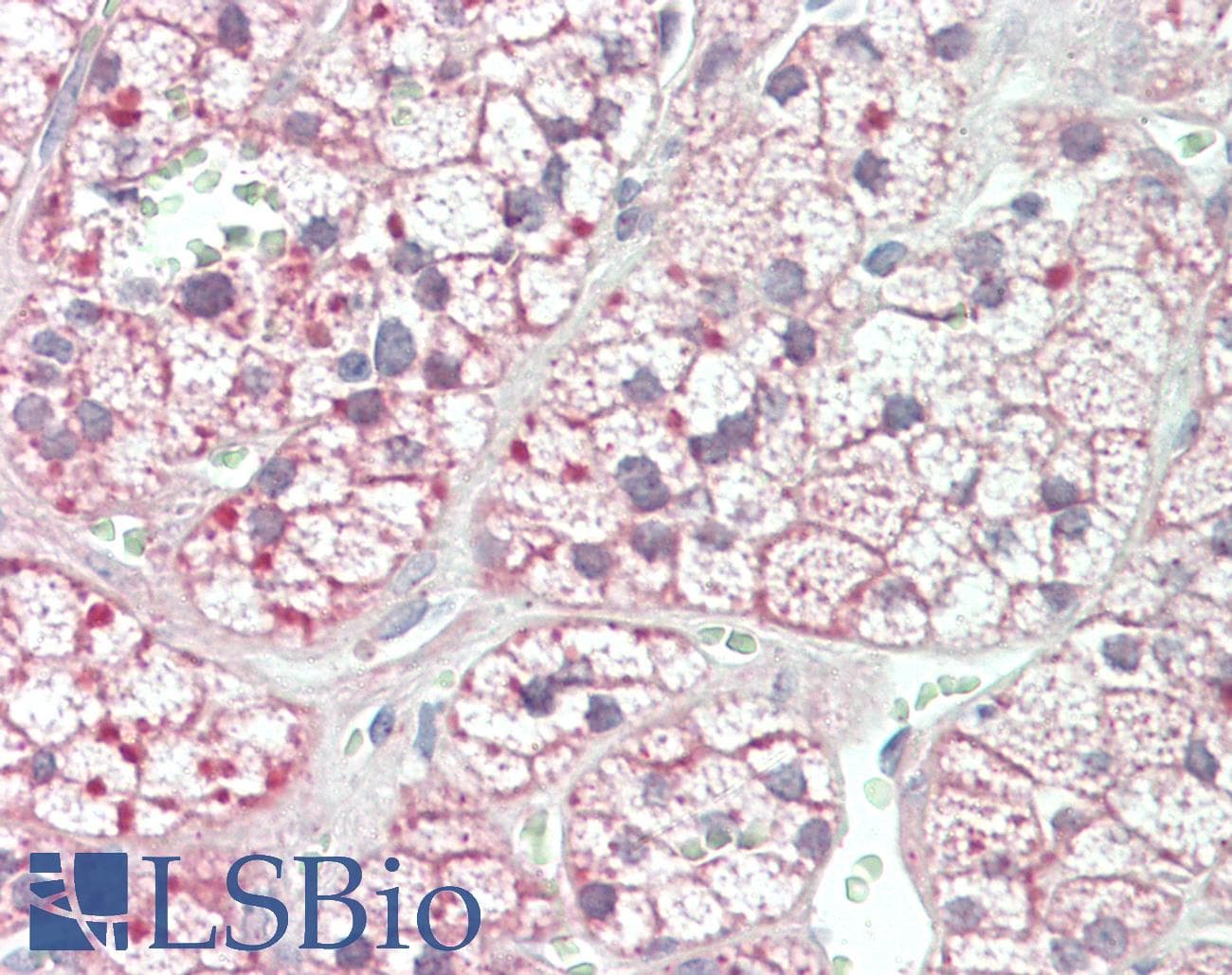 IHC-plus™ Polyclonal Rabbit anti-Human Acetyl-CoA Carboxylase / ACC Antibody (aa2333-C-term, IHC, WB)