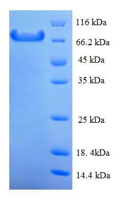 Mouse CAPN1 / Calpain 1 Protein (Recombinant His)