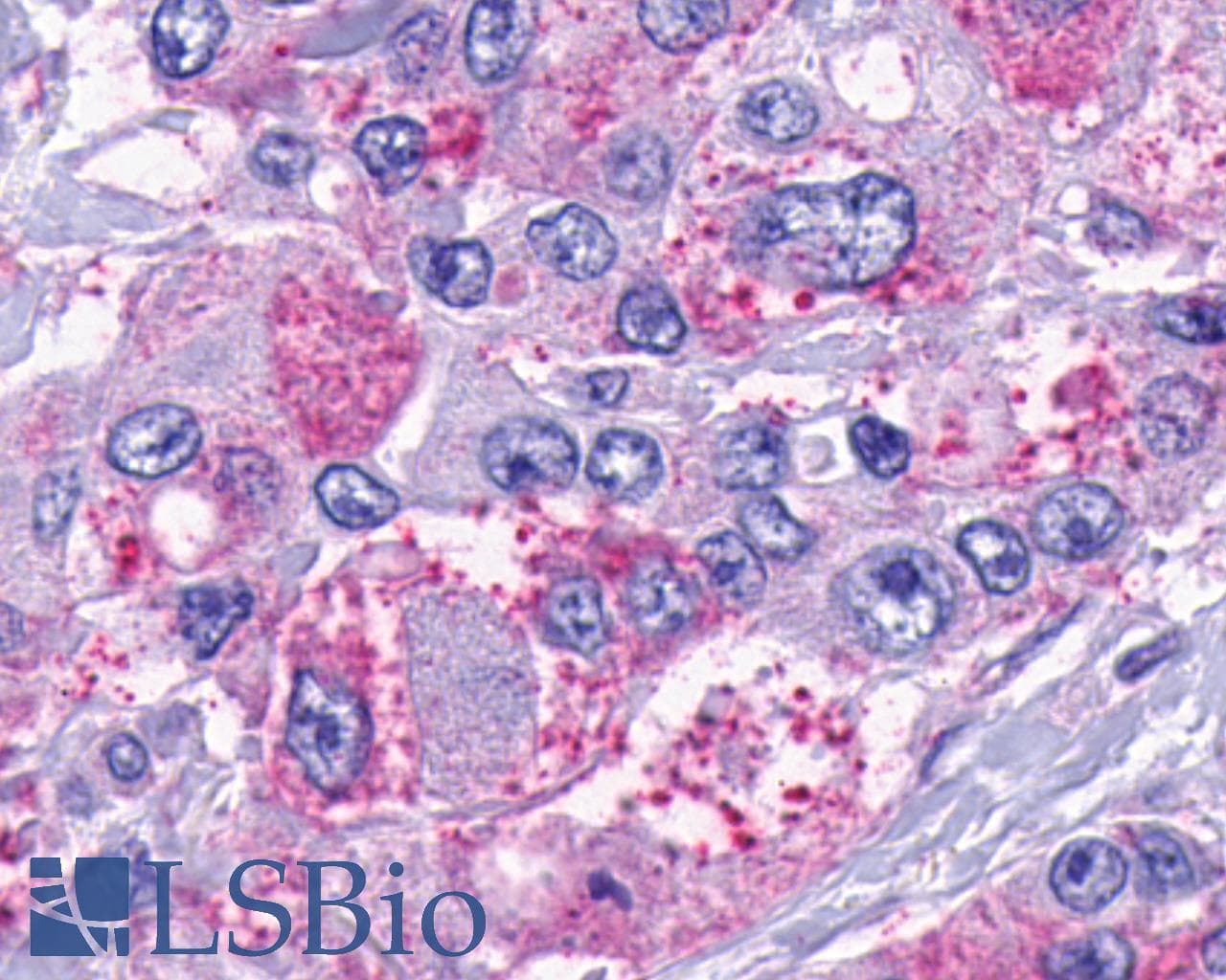 PathPlus™ TACR2 / NK2R Antibody (C-Terminus)